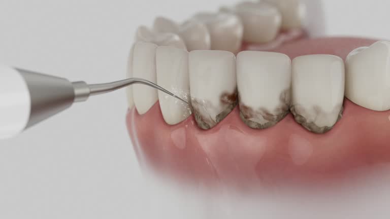 Trusted Emergency Dentist service in Chattahoochee, FL - Dentist Open Now